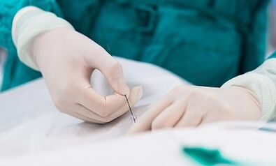 Diagnóstico de varices dunha pequena pelve
