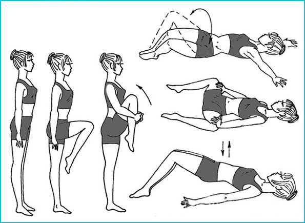 exercicios para varices da pelve